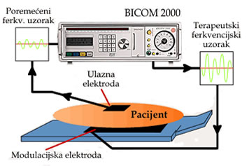 Liječenje sa biorezonancom